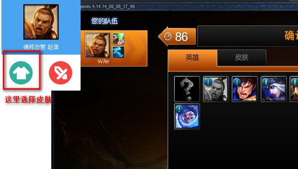 樂(lè)派英雄聯(lián)盟寶盒