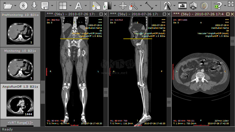 Sante DICOM Viewer Pro(醫(yī)學(xué)DICOM圖像瀏覽器)