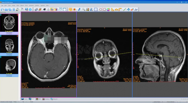 Sante DICOM Viewer Pro(醫(yī)學(xué)DICOM圖像瀏覽器)