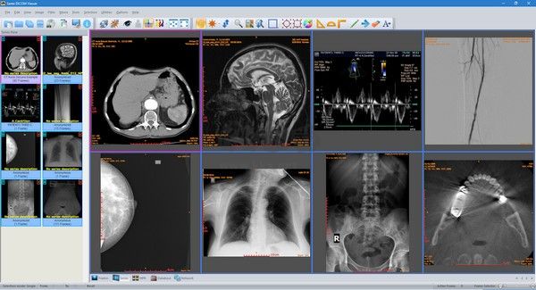 Sante DICOM Viewer Pro(醫(yī)學(xué)DICOM圖像瀏覽器)